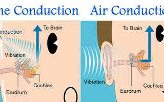 Hearing the World, Healthily: How Bone Conduction is Redefining Your Listening Experience