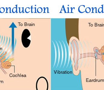 Hearing the World, Healthily: How Bone Conduction is Redefining Your Listening Experience