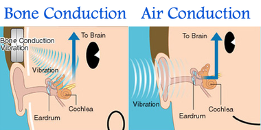 Hearing the World, Healthily: How Bone Conduction is Redefining Your Listening Experience